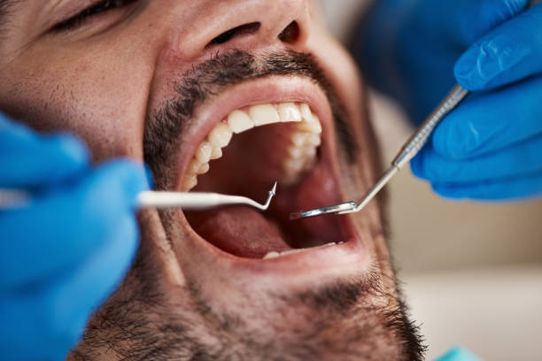 Best Broken Tooth Emergency  in Sulphur Springs, TX